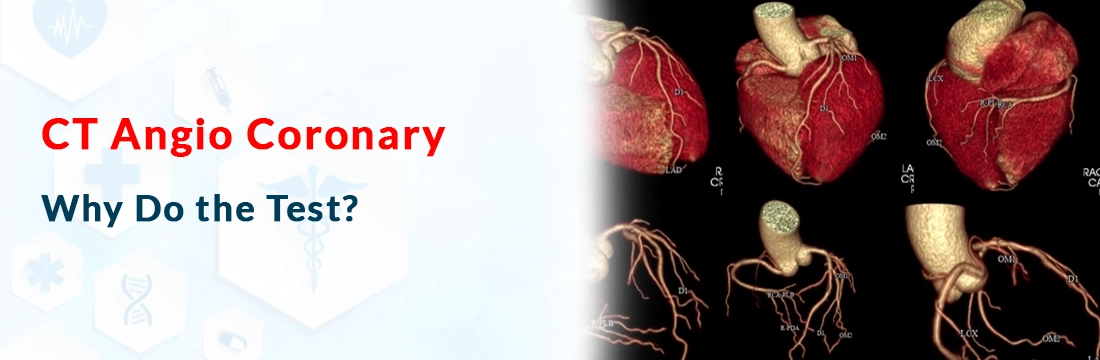 CT Angio Coronary: Why Do the Test?